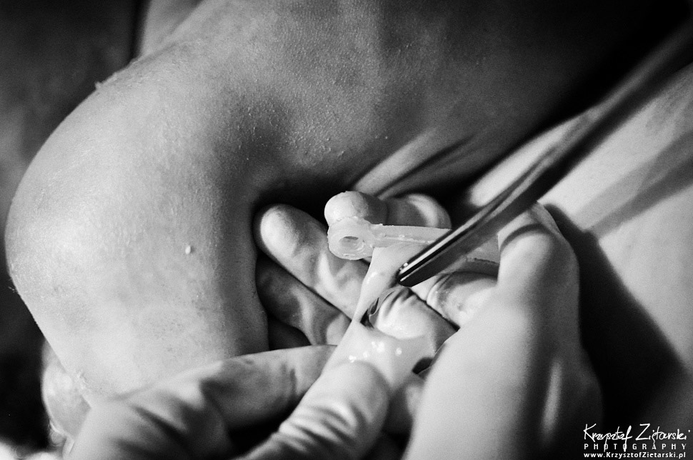 Zdjęcia z narodzin, fotografie z porodu, reportaż